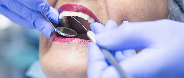 Best Emergency Tooth Extraction in Pine Ridge, SC